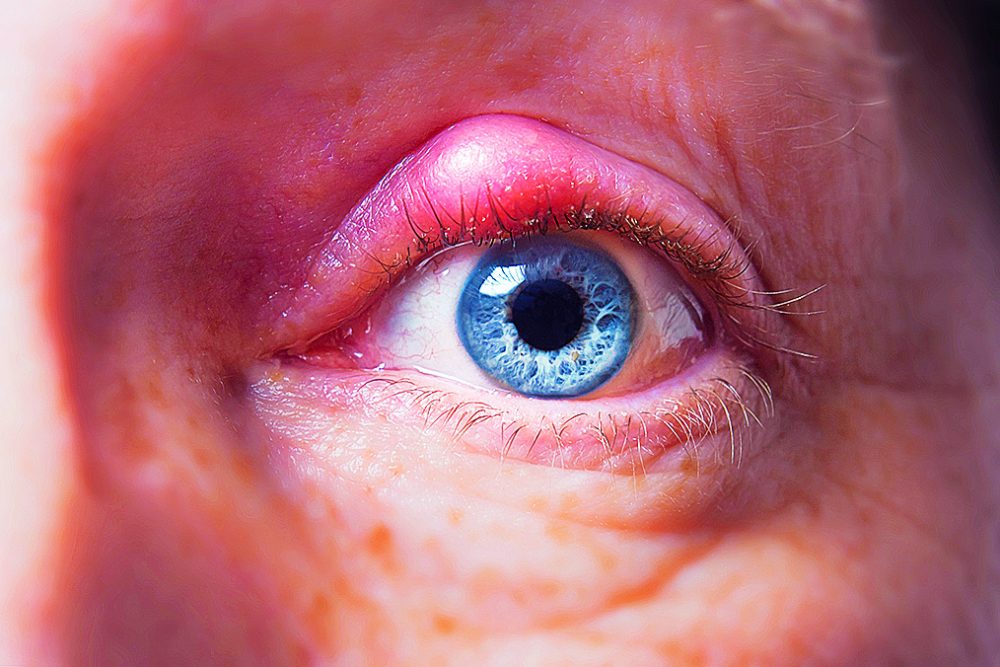 shutterstock_98763323